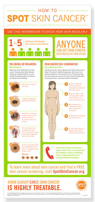 how-to-spot-skin-cancer-infographic-thumbnail.jpg